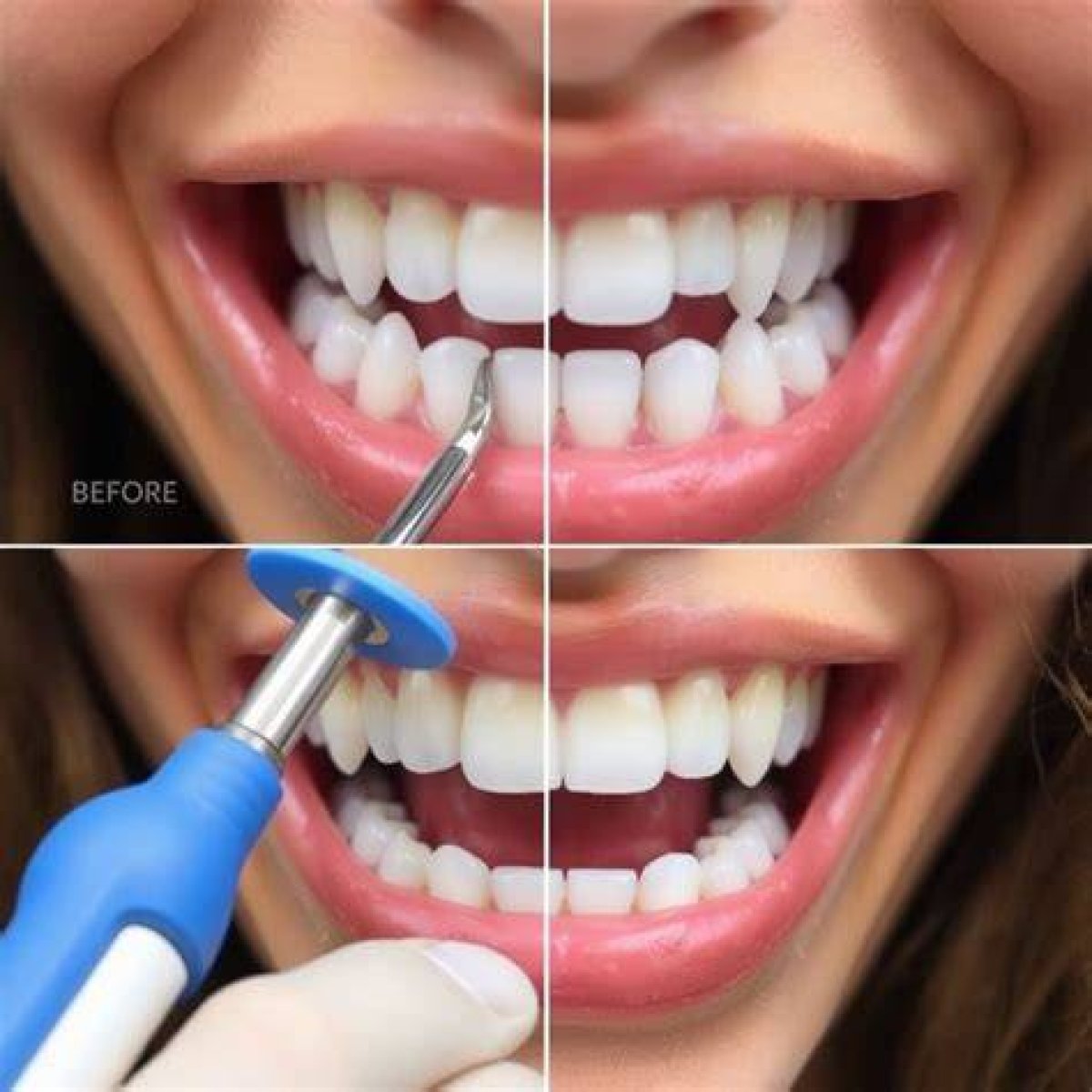 Before and After, Cost, and More