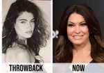 Kimberly Guilfoyle's Transformation: a Visual Journey of Plastic Surgery