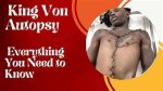 Lking Von Autopsy: the Enigmatic Life and Legacy