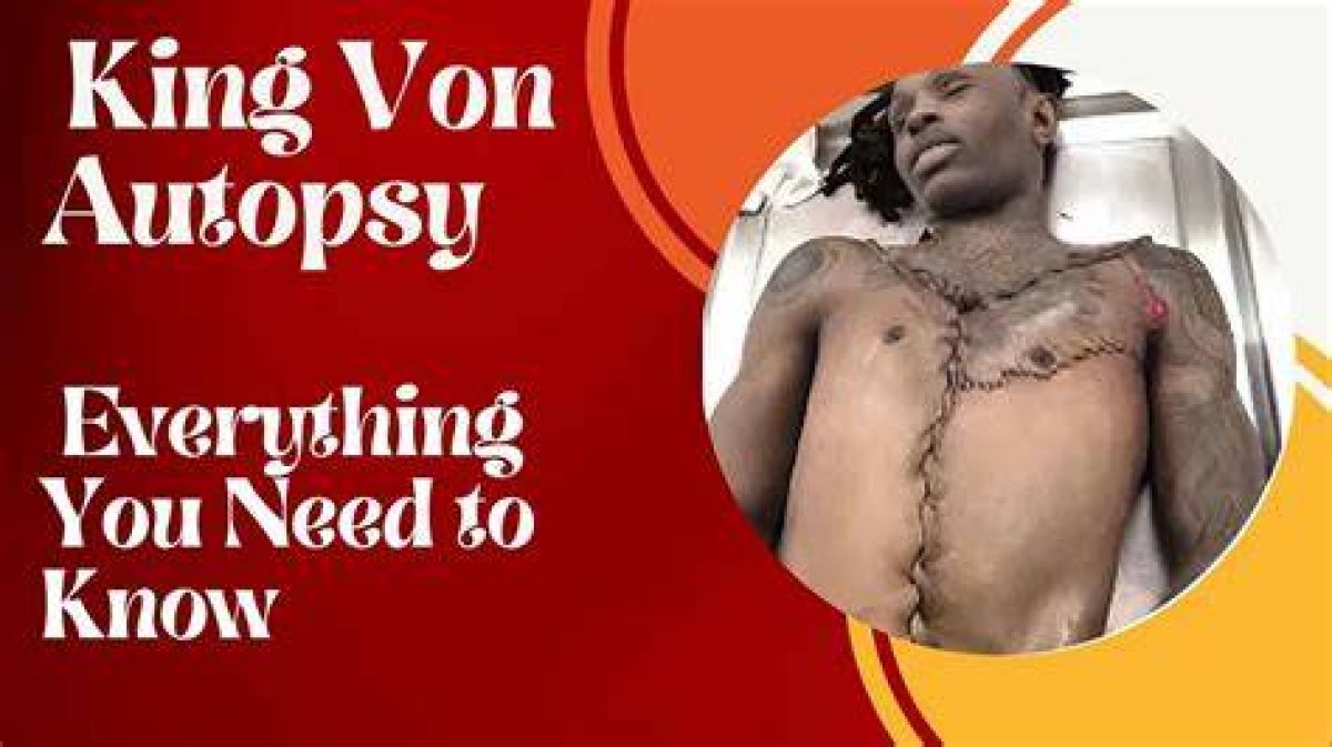Understanding the King Von Autopsy Result: a Deep Dive into His Untimely Death