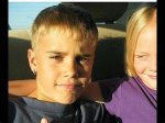 Unraveling the Mystery of Justin Bieber's Hair Loss