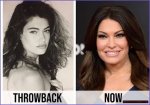 Unveiling the Transformation: Kimberly Guilfoyle Before and After