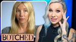 Unveiling the Truth Behind Kimber James Botched