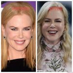 Unveiling the Truth Behind Nicole Kidman’s Facelifts