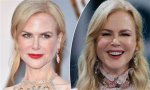 Why Nicole Kidman's Fillers Are the Talk of the Town